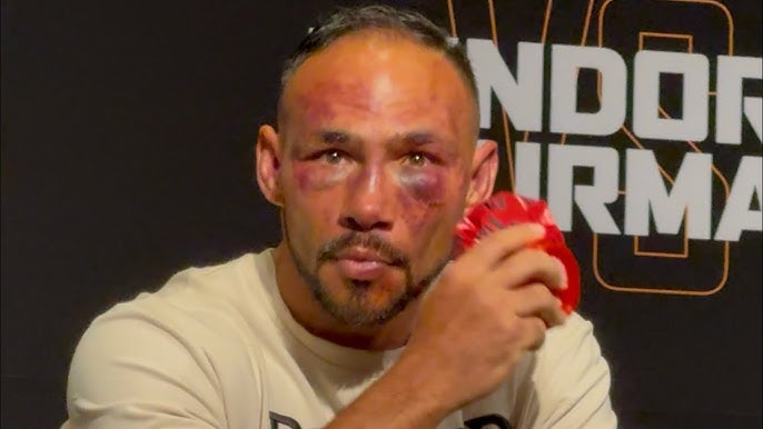 THURMAN KWESTIONUJE PRZERWANIE WALKI Z FUNDORĄ. “TO BYŁA ZBYT WCZESNA DECYZJA”